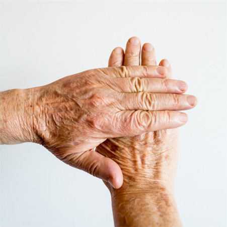 Aging Hands